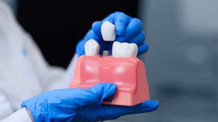Diş kaybı sorunlarında implant tedavisi en çok tercih edilen çözümler arasında”