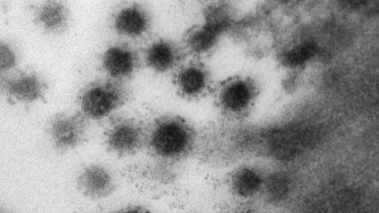 Koronavirüsün delta varyantı Rusyada görüntülendi