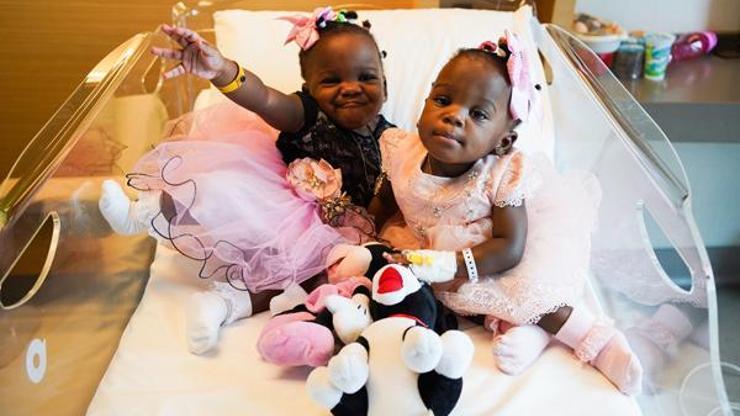 Kamerunlu siyam ikizleri, Türkiyede şifa buldu