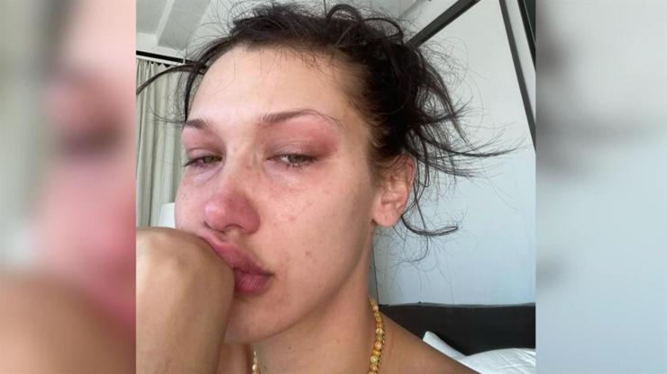 Ünlü model Bella Hadid gözyaşlarını paylaştı