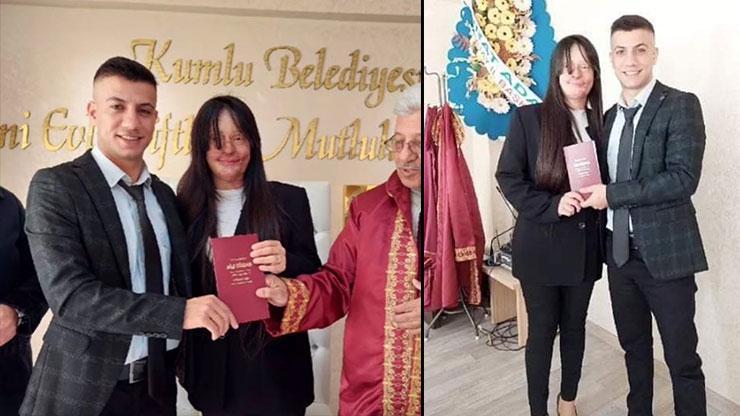 Türkiye günlerce Berfin Özeki konuşmuştu Yüzüne asit atan erkek arkadaşıyla evlendi