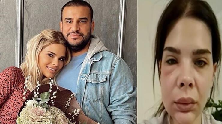 Damla Ersubaşı boşandığı eşi Mustafa Can Keserden şiddet gördü mü