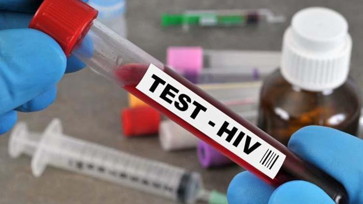 Oxford duyurdu: Yeni HIV varyantı AIDS vakalarını iki katına çıkarabilir
