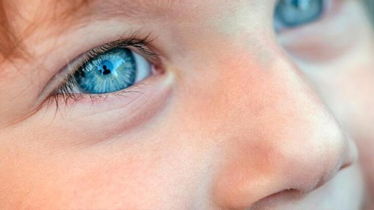 A vitamini eksikliği çocuklarda gözleri nasıl etkiliyor