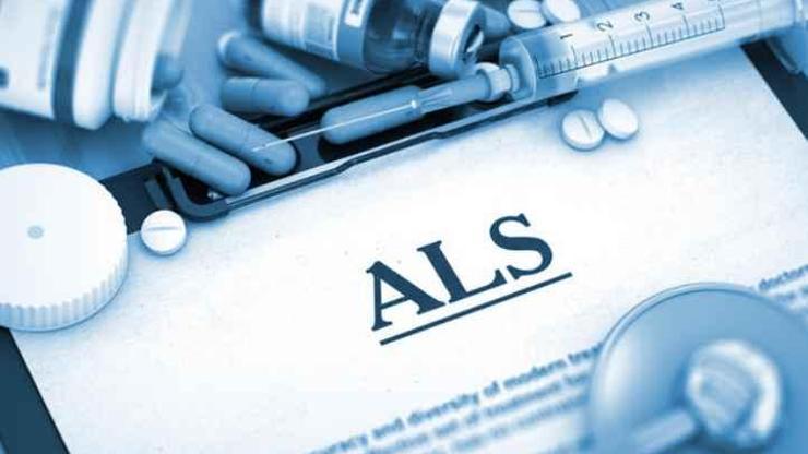 ALSnin erken teşhisinde umut olacak çalışma