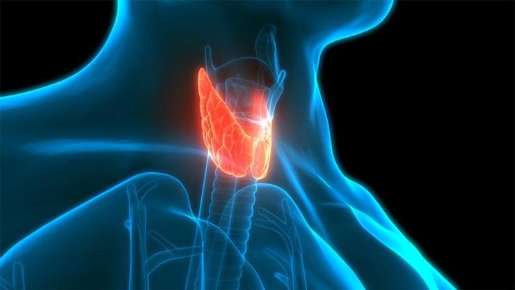 Tiroid kanserinde radyoaktif iyot tedavisi, kime uygulanır