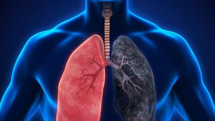 Akciğeri bitiriyor Bilimsel çalışmalar tehlikeyi ortaya koydu En önemli kanser nedenlerinden biri