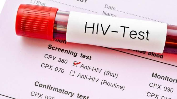 Prof. Dr. Şener: Sessiz bir HIV pandemisi var