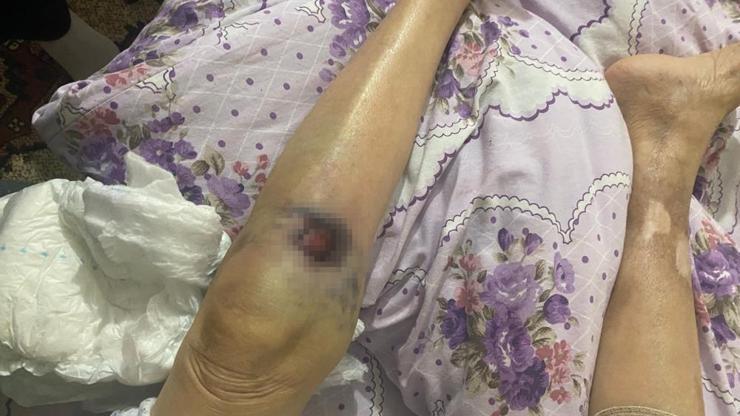 Ankara’da bakıcı dehşeti: 91 yaşındaki yaşlı kadın hastanede ölüm kalım savaşı veriyor