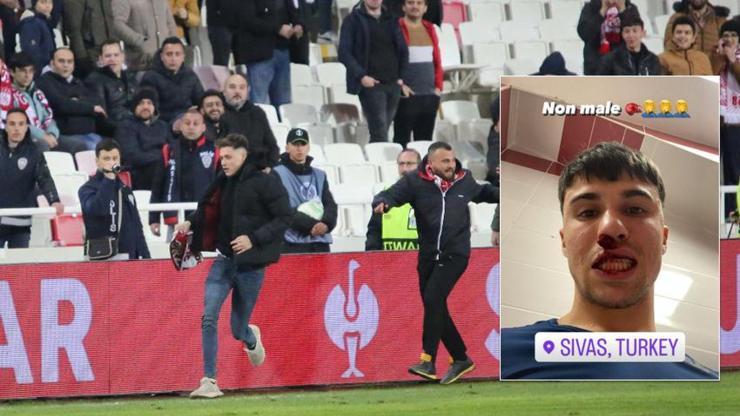 Sivasspor-Fiorentina maçında rakibe yumruklu saldırı Kanlar içinde kaldı
