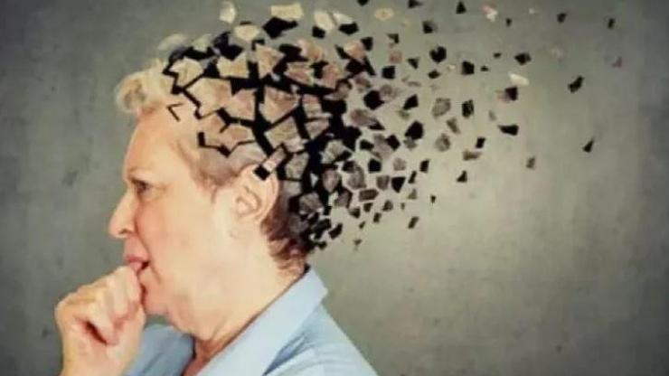 Alzheimer kadınlarda daha çok görülüyor