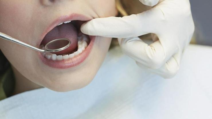 Oruç tutarken diş çektirmek orucu bozar mı Diyanete göre oruçluyken diş tedavisi orucu bozar mı