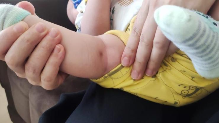 Doğduğundan beri ağlayan Adem bebeğin vücudunda enjektör iğnesi çıktı