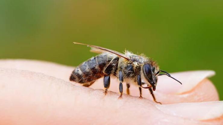 Arı alerjisine dikkat Ölüme neden olur mu Arı alerjisinden korunmanın yolları