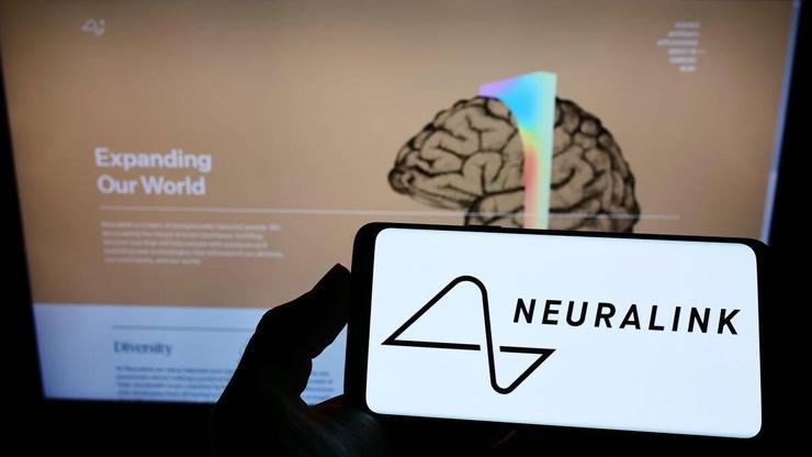 Muskın beyin implantı girişimi Neuralink, insanlı deney için onay aldı