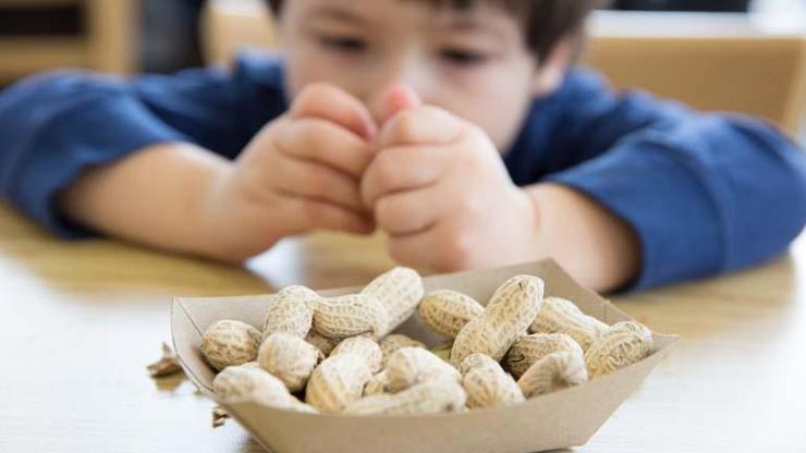 Bebeklerde ve çocuklarda besin alerjileri arttı Dikkat Bu besinler alerjiye neden oluyor