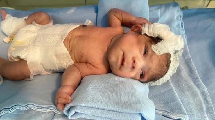 515 gram doğmuştu Elif bebek, 98 günlük tedavi sonrası hayata tutundu