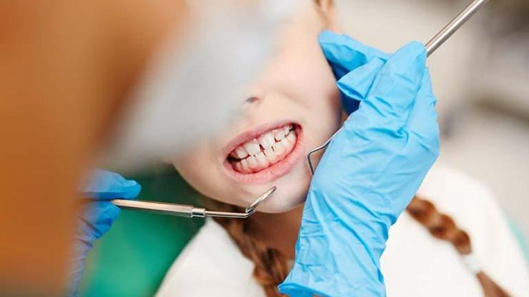 Çocuklarda diş sağlığı: Süt dişleri arasında boşluğa dikkat, dişlerde çapraşıklığa neden oluyor