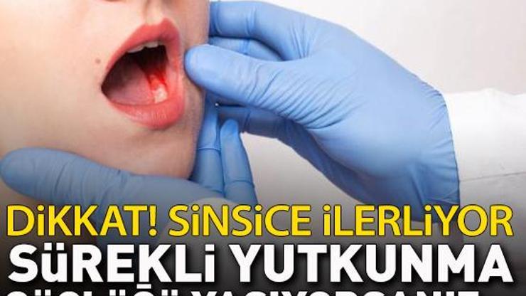 Dikkat Sinsice ilerliyor... Bu şikayetleri hafife almayın: 3 haftadan uzun süren yutkunma güçlüğü, boyunda şişlik...