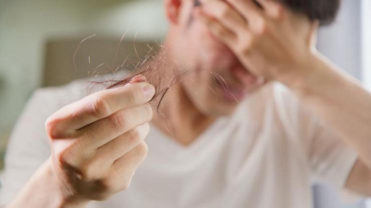 Saç dökülmesini önleyen doğal yöntem Faydaları saymakla bitmiyor, etkisi görenleri şaşırtıyor