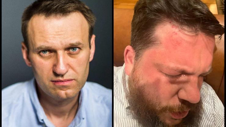 Navalniye yakın isimlerden Leonid Volkov, Litvanyada saldırıya uğradı