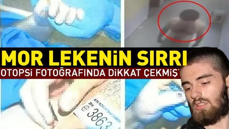 SON DAKİKA Cem Garipoğlunun otopsi fotoğrafında dikkat çekmişti Mor lekenin sırrı ne