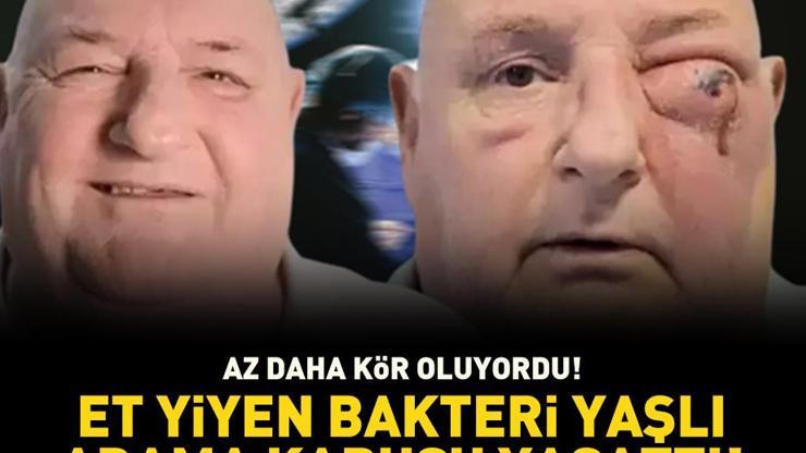 Diş ağrısı şikayetiyle hastaneye gitti, az daha kör oluyordu Et yiyen bakteri’ yaşlı adama kabusu yaşattı