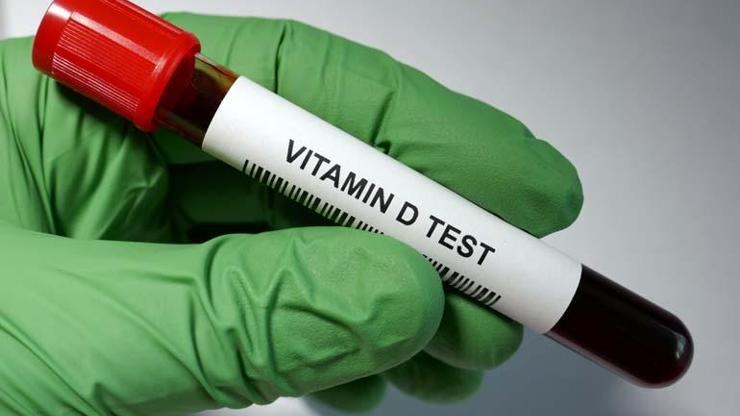 D vitamini üretimini etkileyen faktörler Prof. Dr. Osman Müftüoğlu yazdı
