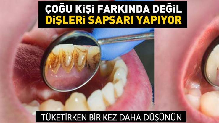 İnci gibi dişleri sapsarı yapıyor Tüketirken bir kez daha düşünün... Dişlere zarar veren 8 hatalı alışkanlık