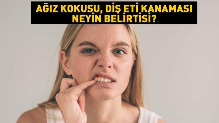 Kötü ağız kokusu, dişlerin gevşemesi, diş eti kanaması neyin belirtisi