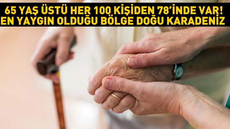 65 yaşını geçmiş her 100 kişiden 78inde var En yaygın olduğu bölge Doğu Karadeniz Prof. Dr. Tevfik Özlüden hayati uyarı