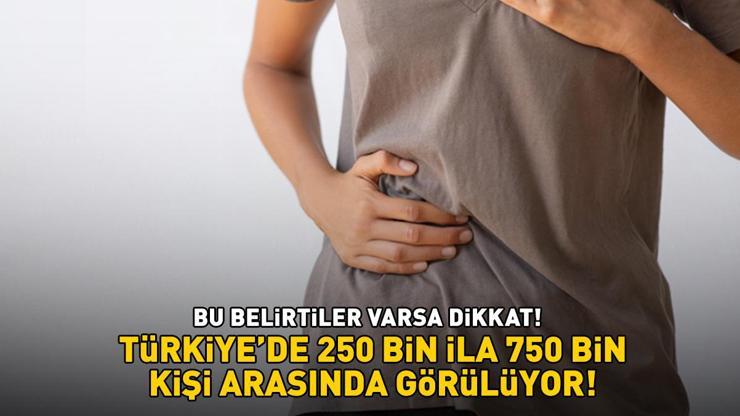 Bu belirtiler varsa dikkat Sadece Türkiyede 250 bin ile 750 bin kişi arasında görülüyor