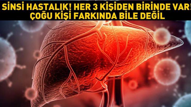 Sinsi hastalık Ülkemizde her 3 kişiden birinde var... Hastaların çoğu taşıyıcı olduğunun farkında bile değil Bulaş yollarına dikkat: Manikür, pedikür, kuaför, dövme...