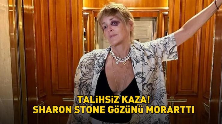 Bodrum’da talihsiz kaza Temel İçgüdünün yıldızı Sharon Stone gözünü morarttı