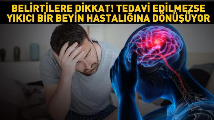 Geçer diye beklemeyin... Bu belirtiler başladıysa hemen doktora koşun Tedavi edilmezse yıkıcı bir beyin hastalığına dönüşüyor