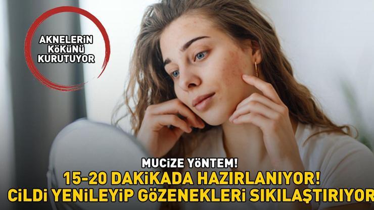 15-20 dakikada hazırlanıyor, cildi yenileyip gözenekleri sıkılaştırıyor Mucize yöntem: Sivilce ve aknelerin kökünü kurutuyor