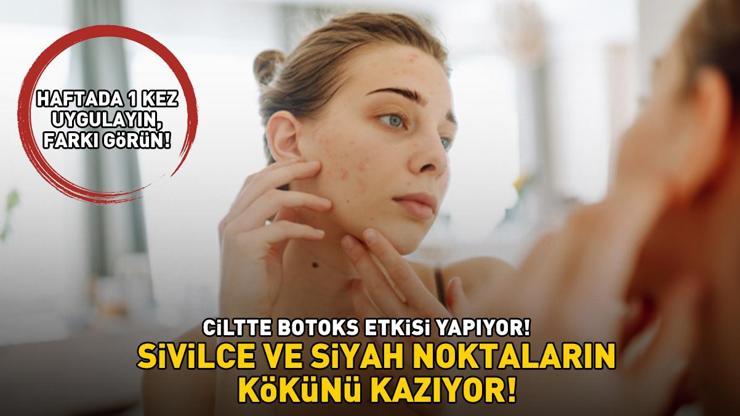 Sivilce ve siyah noktaların kökünü kazıyor Ciltte botoks etkisi yapıyor Haftada 1 kez uygulayın, farkı görün