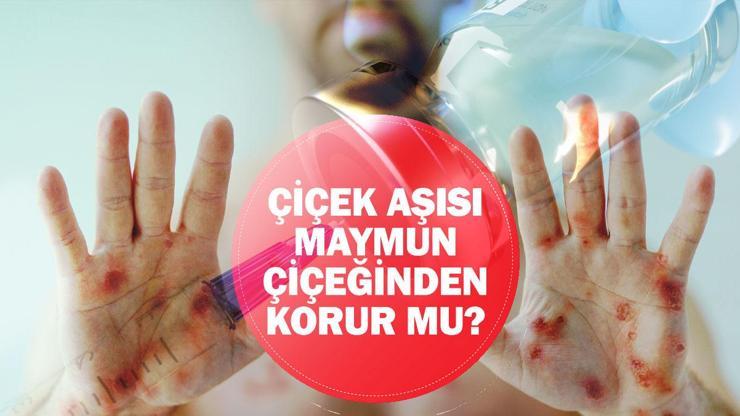 Çiçek aşısı maymun çiçeğine (Mpox) karşı korur mu