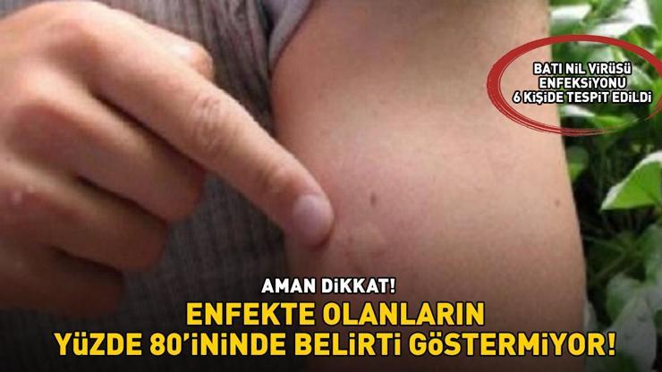 BATI NİL VİRÜSÜ ENFEKSİYONU TÜRKİYEDE 6 KİŞİDE TESPİT EDİLDİ Aman dikkat Enfekte olanların yüzde 80’ninde belirti göstermiyor