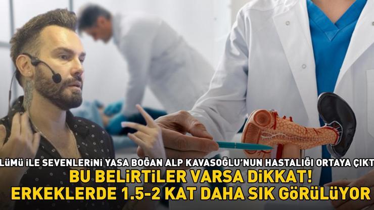 MAKYAJ ARTİSTİ ALP KAVASOĞLU HAYATINI KAYBETTİ Erkeklerde 1,5-2 kat daha sık görülüyor, bu belirtiler varsa dikkat