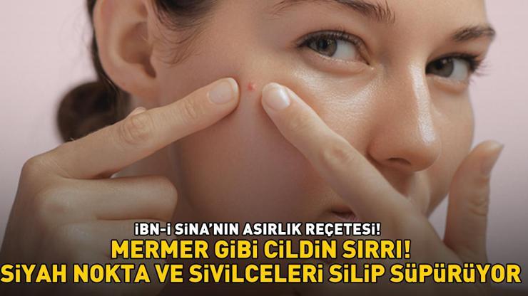 İBN-İ SİNANIN ASIRLIK REÇETESİ Siyah nokta, akne ve sivilceleri silip süpürüyor MERMER GİBİ CİLDİN SIRRI