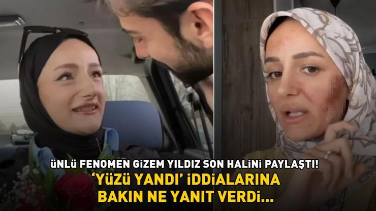 Amin Reis lakaplı fenomen Gizem Yıldız son halini paylaştı Yüzünün yandığı iddia edilmişti, meğer gerçek başkaymış