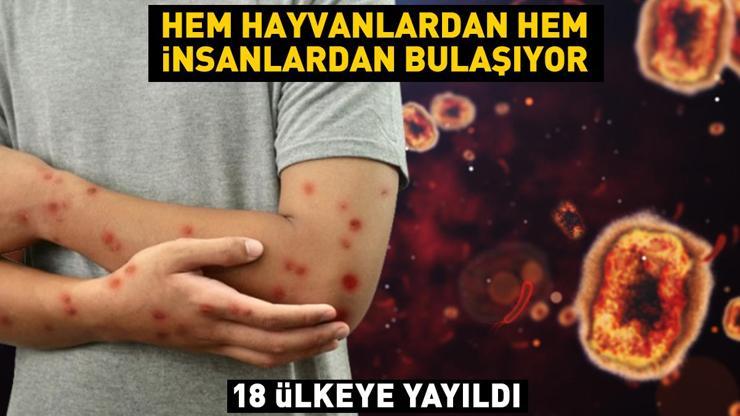 18 ülkeye yayıldı Hem hayvanlardan hem insanlardan bulaşıyor