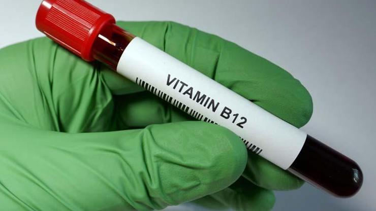 B12 vitamini neden önemli B12 değerimizin düştüğünü nasıl anlarız B12 deposu besinler