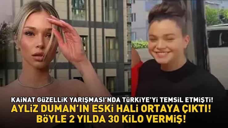 Kainat Güzellik Yarışmasında Türkiyeyi temsil eden Ayliz Dumanın eski hali ortaya çıktı Meğer böyle 2 yılda 30 kilo vermiş