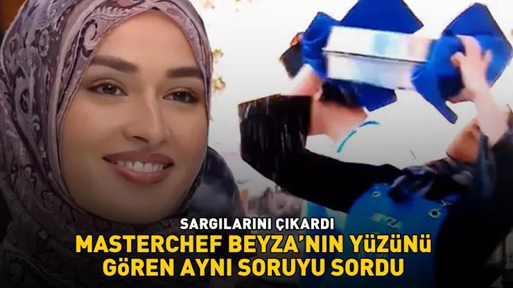 YÜZÜ YANMIŞTI MasterChef Beyza sargılarını çıkarınca herkes şoke oldu: EN UFAK YARA İZİ YOK