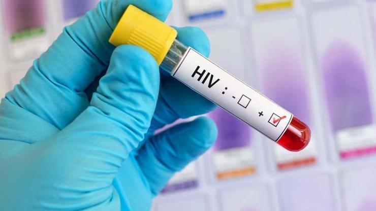 AIDS şüphesine test önerisi Bu belirtiler önemsenmiyor ama...