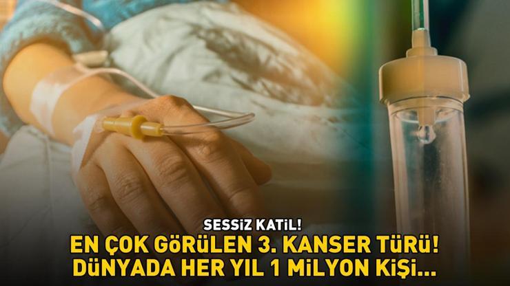 SESSİZ KATİL Dünyada en çok görülen 3. kanser türü Her yıl 1 milyon kişi, Türkiyede ise 6 bin vatandaş bu hastalığa yakalanıyor