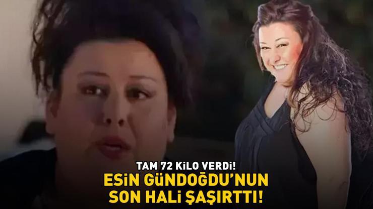 Kocan Kadar Konuşun Saniyesi Esin Gündoğdunun son hali şaşırttı Tam 72 kilo verdi