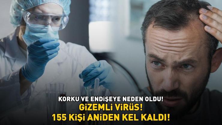 155 KİŞİ ANİDEN KEL KALDI Koronavirüs, HMPV ve Norovirüsten sonra şimdi de bu Gizemli virüs korku ve endişeye neden oldu